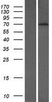 BTBD9 Overexpression Lysate