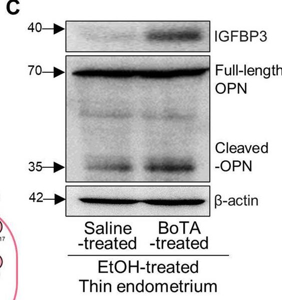 IGFBP-3 Antibody (MM0342-6U23) - Azide and BSA Free