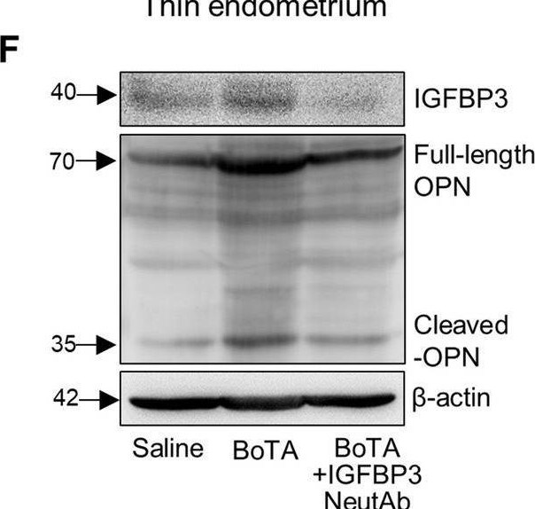 IGFBP-3 Antibody (MM0342-6U23) - Azide and BSA Free