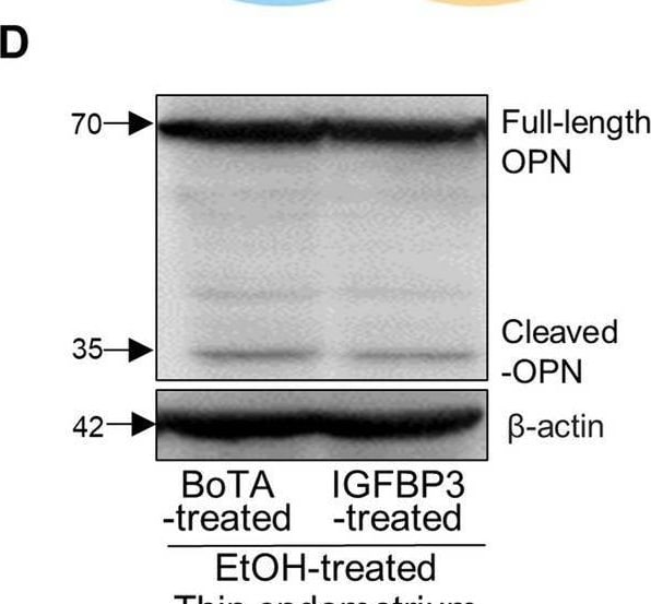 IGFBP-3 Antibody (MM0342-6U23) - Azide and BSA Free