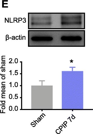 NLRP3/NALP3 Antibody - BSA Free