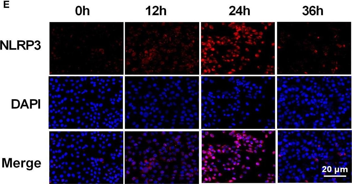 NLRP3/NALP3 Antibody - BSA Free
