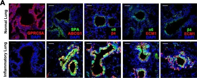 Surfactant Protein A Antibody