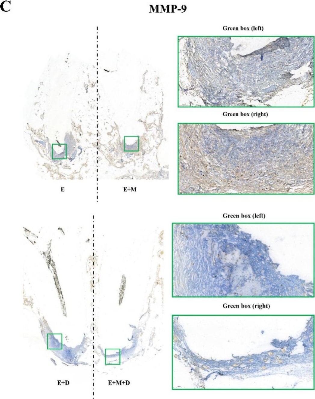MMP-9 Antibody (4A3) - BSA Free
