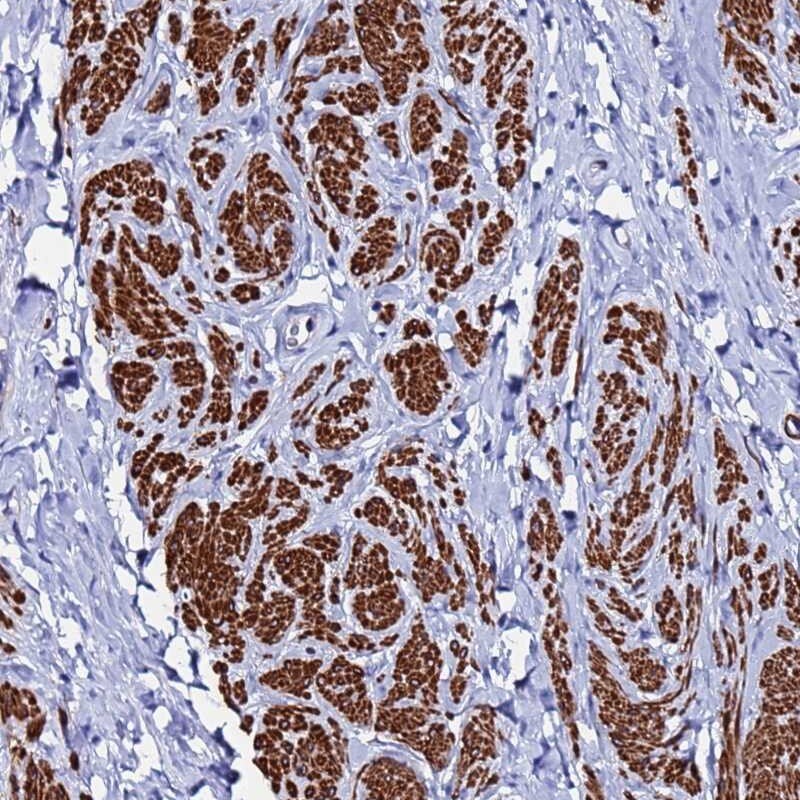 RAB39 Antibody - BSA Free Immunohistochemistry: RAB39 Antibody - BSA Free [NBP2-13193]