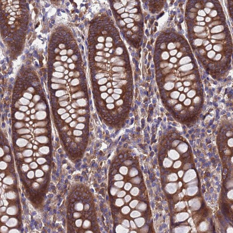 RABEP2 Antibody - BSA Free Immunohistochemistry: RABEP2 Antibody - BSA Free [NBP2-13195]