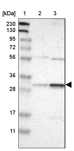Rad1 Antibody - BSA Free Western Blot: Rad1 Antibody - BSA Free [NBP2-13196]