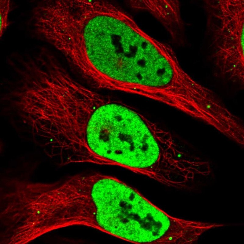 RALY Antibody - BSA Free Immunocytochemistry/ Immunofluorescence: RALY Antibody [NBP2-13200]
