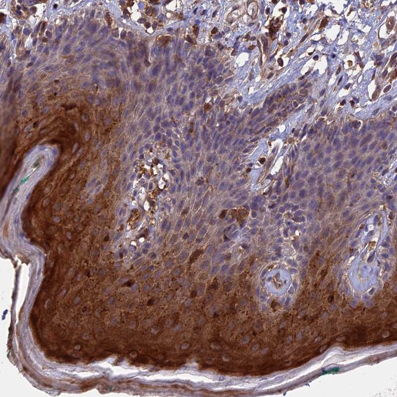 RASAL1 Antibody - BSA Free Immunohistochemistry: RASAL1 Antibody - BSA Free [NBP2-13204]