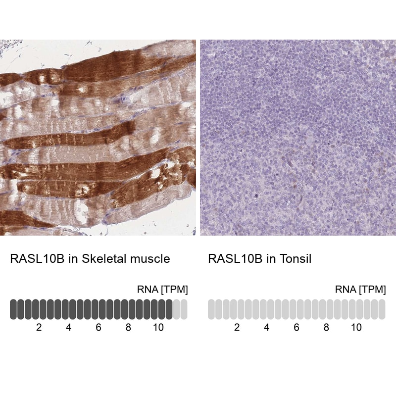 RASL10B Antibody - BSA Free Immunohistochemistry: RASL10B Antibody - BSA Free [NBP2-13205]