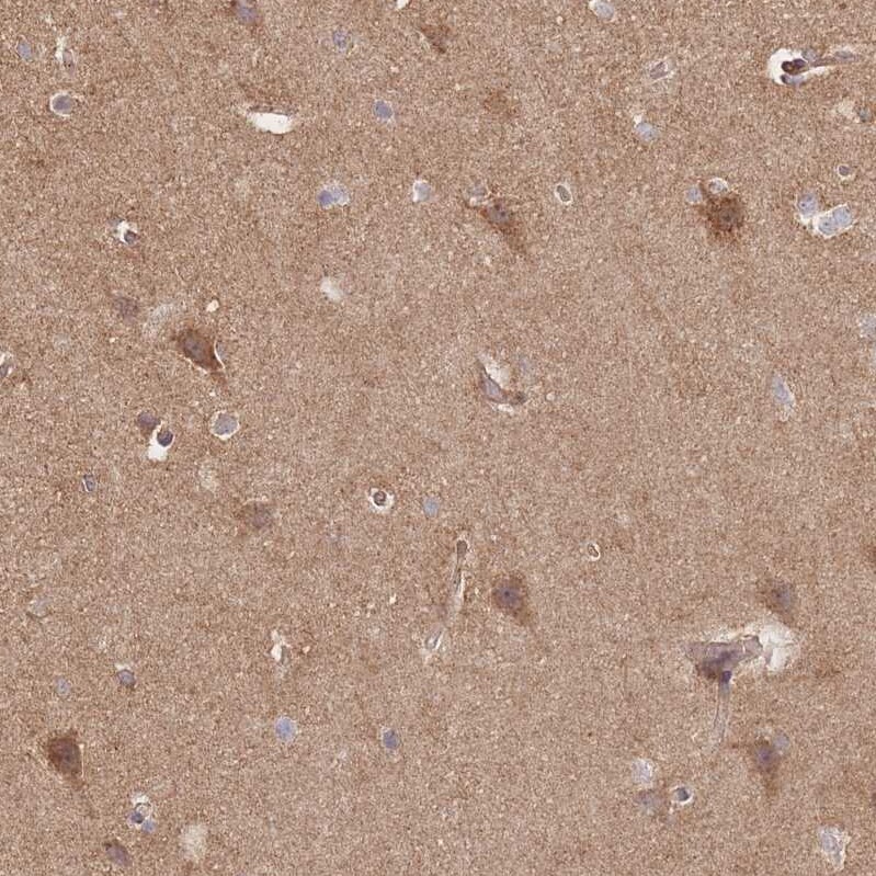 RASSF2 Antibody - BSA Free Immunohistochemistry: RASSF2 Antibody - BSA Free [NBP2-13206]