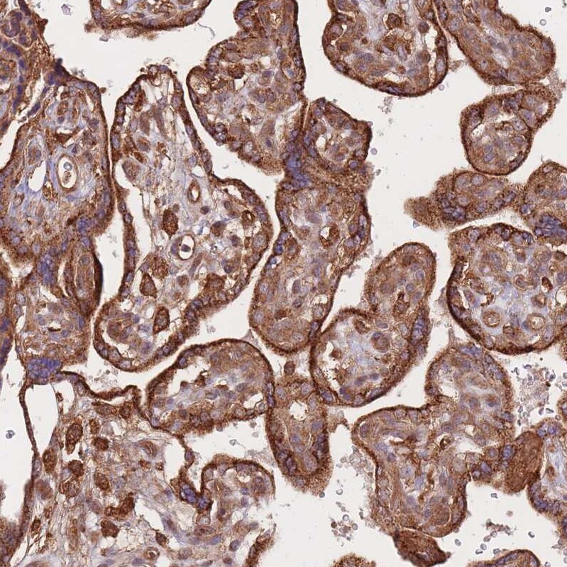 RASSF2 Antibody - BSA Free Immunohistochemistry: RASSF2 Antibody - BSA Free [NBP2-13206]