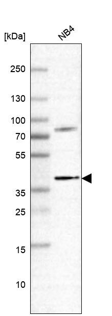 RASSF2 Antibody - BSA Free Western Blot: RASSF2 Antibody - BSA Free [NBP2-13206]