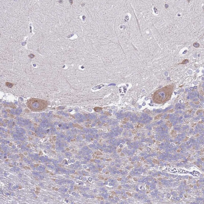 MNAB Antibody - BSA Free Immunohistochemistry: MNAB Antibody - BSA Free [NBP2-13212]