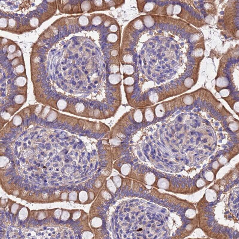 MNAB Antibody - BSA Free Immunohistochemistry: MNAB Antibody - BSA Free [NBP2-13212]