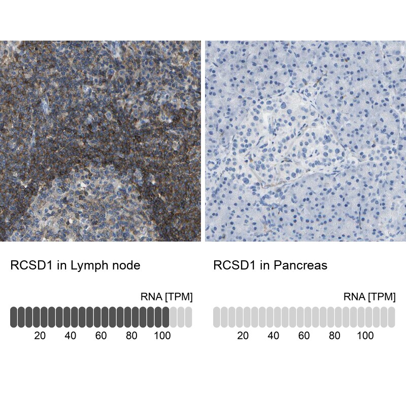 RCSD 1 Antibody - BSA Free Immunohistochemistry: RCSD 1 Antibody - BSA Free [NBP2-13214]
