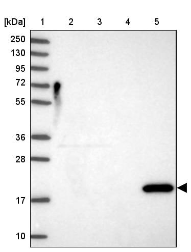 Reg1A Antibody - BSA Free Western Blot: Reg1A Antibody - BSA Free [NBP2-13215]