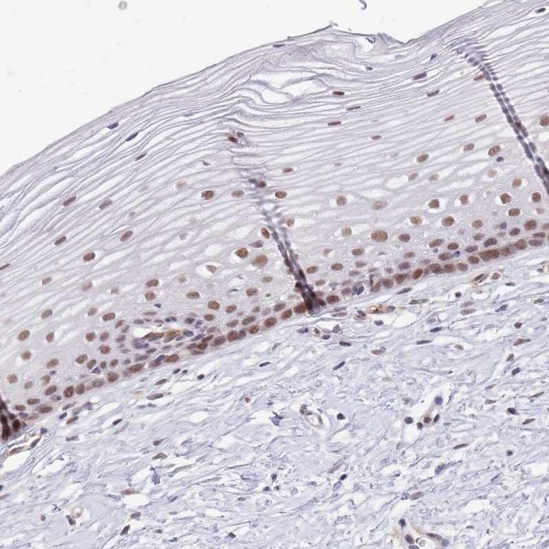 RFX1 Antibody - BSA Free Immunohistochemistry: RFX1 Antibody - BSA Free [NBP2-13223]