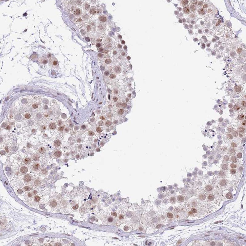 RFX1 Antibody - BSA Free Immunohistochemistry: RFX1 Antibody - BSA Free [NBP2-13223]