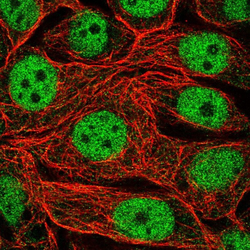 RFXANK Antibody - BSA Free Immunocytochemistry/ Immunofluorescence: RFXANK Antibody - BSA Free [NBP2-13225]