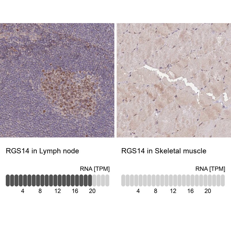 RGS14 Antibody - BSA Free Immunohistochemistry: RGS14 Antibody - BSA Free [NBP2-13227]