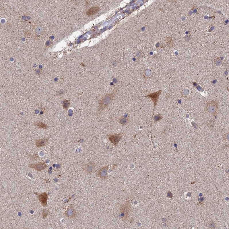 RIC8B Antibody - BSA Free Immunohistochemistry: RIC8B Antibody - BSA Free [NBP2-13232]