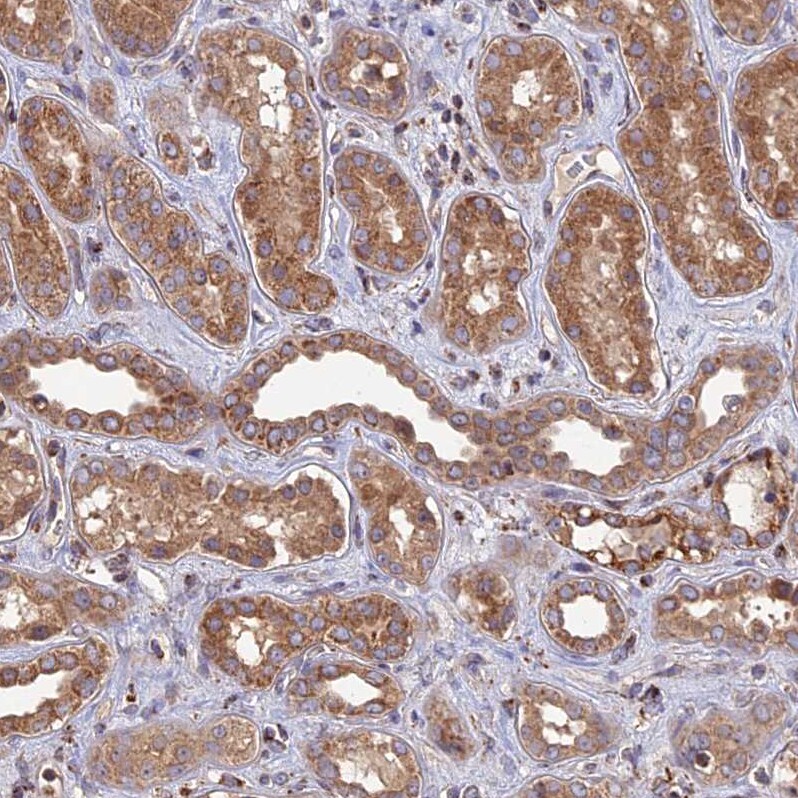 RIC8B Antibody - BSA Free Immunohistochemistry: RIC8B Antibody - BSA Free [NBP2-13232]