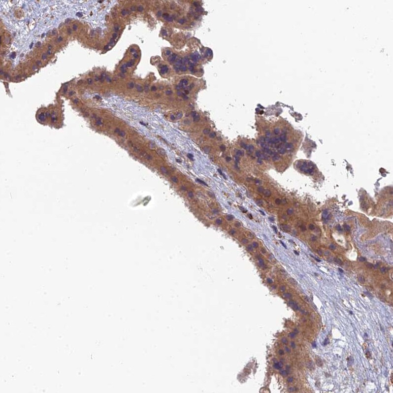 RIC8B Antibody - BSA Free Immunohistochemistry: RIC8B Antibody - BSA Free [NBP2-13232]