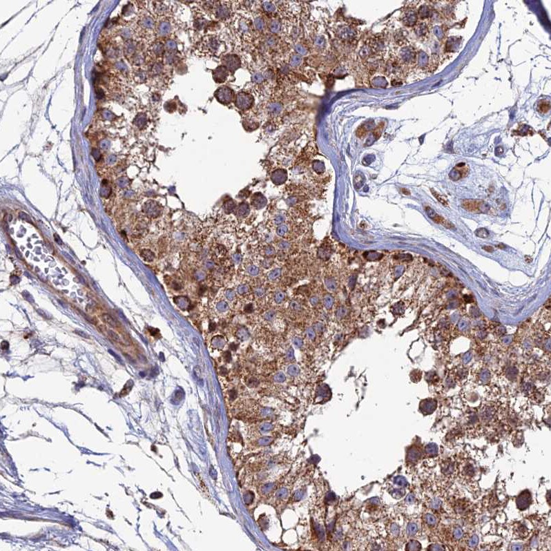 RIC8B Antibody - BSA Free Immunohistochemistry: RIC8B Antibody - BSA Free [NBP2-13232]