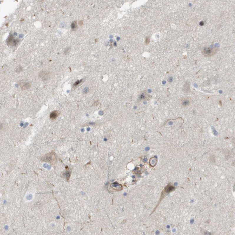 ZNF179 Antibody - BSA Free Immunohistochemistry: ZNF179 Antibody - BSA Free [NBP2-13236]