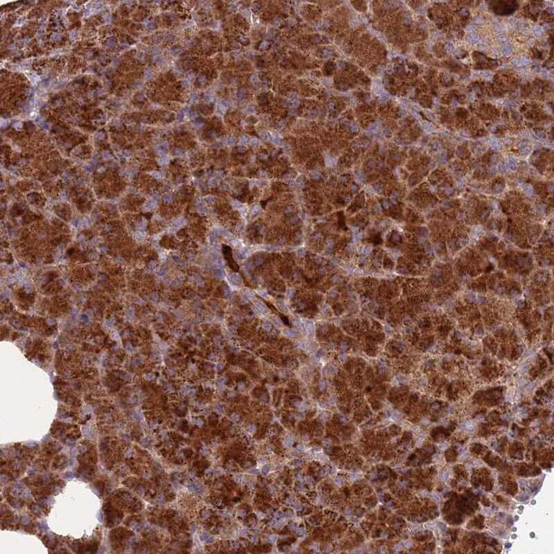 GRAIL/RNF128 Antibody - BSA Free Immunohistochemistry: GRAIL/RNF128 Antibody - BSA Free [NBP2-13237]