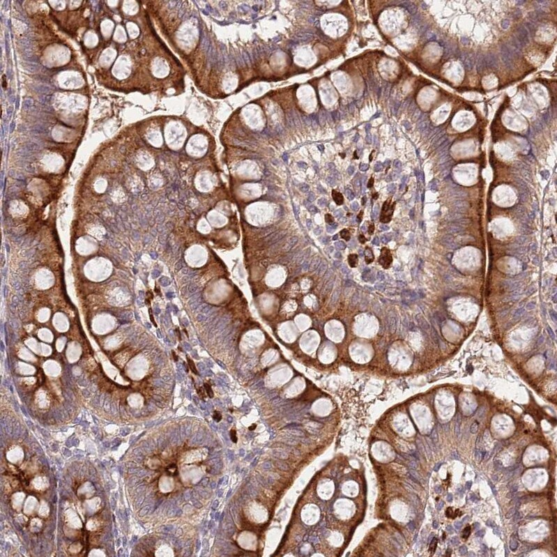 GRAIL/RNF128 Antibody - BSA Free Immunohistochemistry: GRAIL/RNF128 Antibody - BSA Free [NBP2-13237]