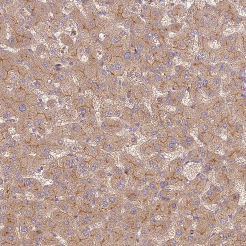 GRAIL/RNF128 Antibody - BSA Free Immunohistochemistry: GRAIL/RNF128 Antibody - BSA Free [NBP2-13237]