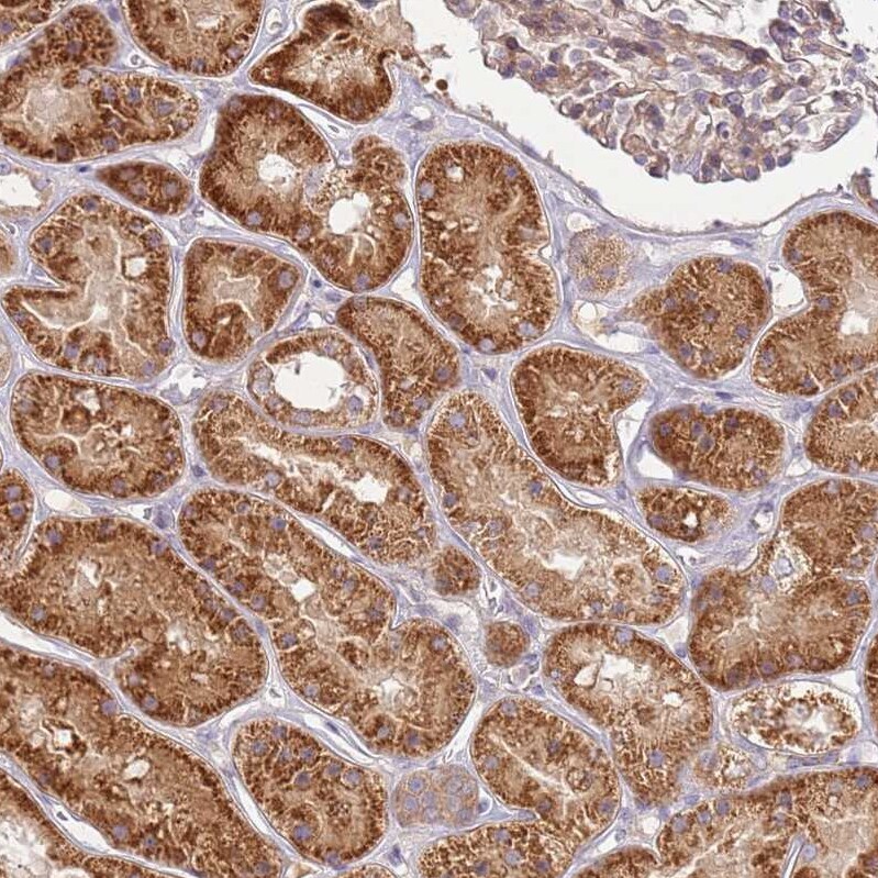 GRAIL/RNF128 Antibody - BSA Free Immunohistochemistry: GRAIL/RNF128 Antibody - BSA Free [NBP2-13237]