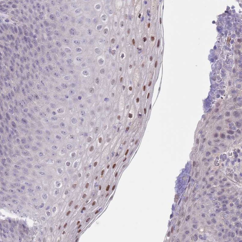 RNF169 Antibody - BSA Free Immunohistochemistry: RNF169 Antibody - BSA Free [NBP2-13239]