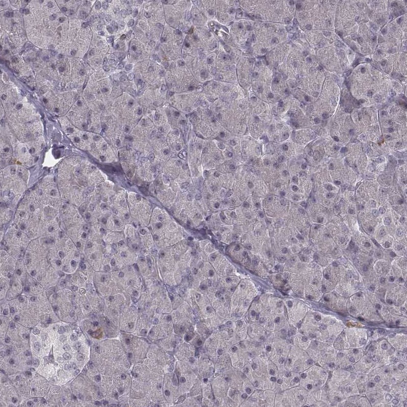 RPGRIP1 Antibody - BSA Free Immunohistochemistry: RPGRIP1 Antibody - BSA Free [NBP2-13249]