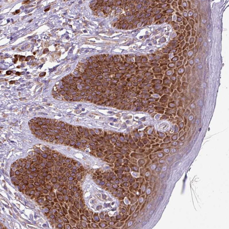 RPL13 Antibody - BSA Free Immunohistochemistry: RPL13 Antibody - BSA Free [NBP2-13250]