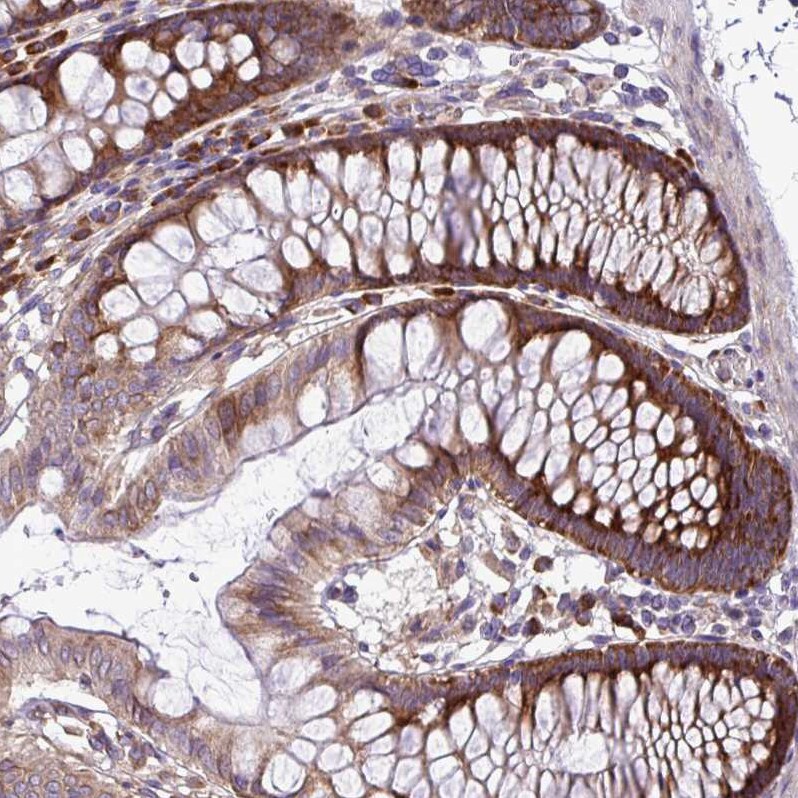 RPL13 Antibody - BSA Free Immunohistochemistry: RPL13 Antibody - BSA Free [NBP2-13250]