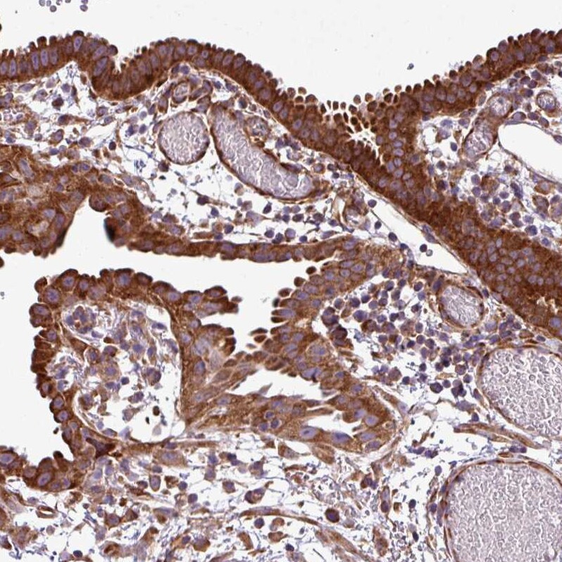 RPL13 Antibody - BSA Free Immunohistochemistry: RPL13 Antibody - BSA Free [NBP2-13250]