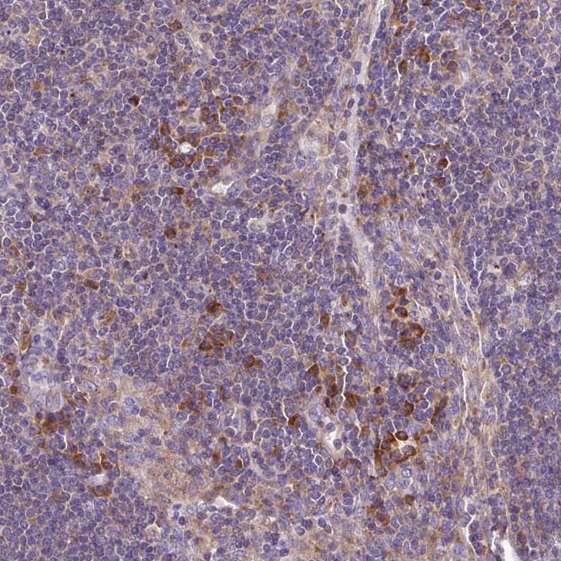 RPL13 Antibody - BSA Free Immunohistochemistry: RPL13 Antibody - BSA Free [NBP2-13250]