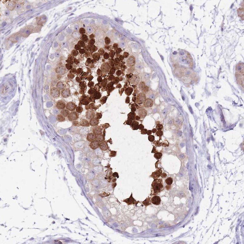 RPL18 Antibody - BSA Free Immunohistochemistry: RPL18 Antibody - BSA Free [NBP2-13251]