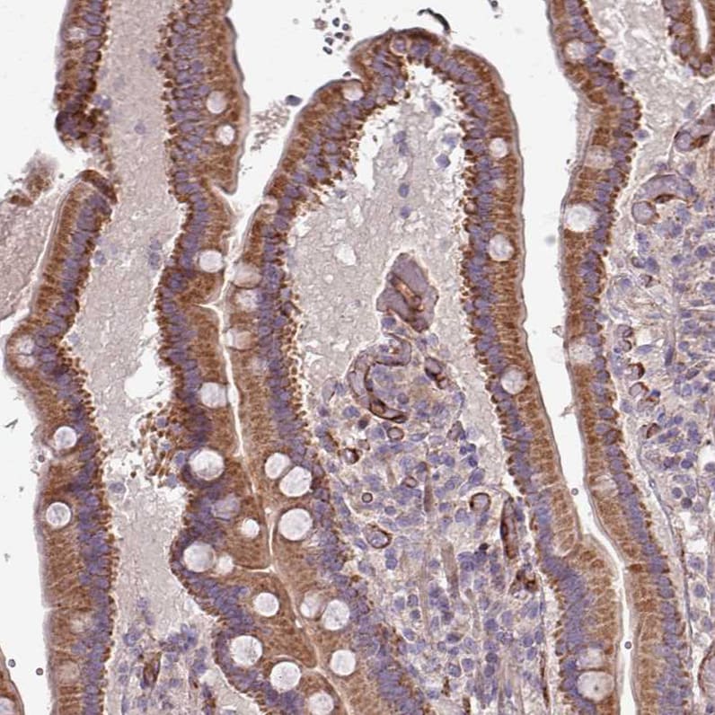 RPL23A Antibody - BSA Free Immunohistochemistry: RPL23A Antibody - BSA Free [NBP2-13253]