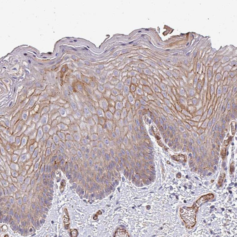 RPL23A Antibody - BSA Free Immunohistochemistry: RPL23A Antibody - BSA Free [NBP2-13253]
