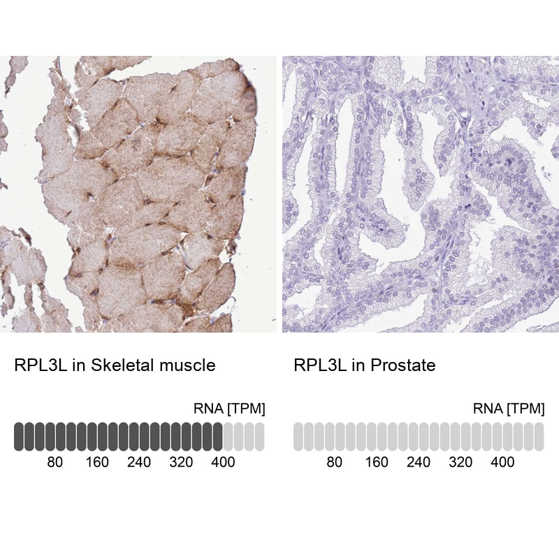 RPL3L Antibody - BSA Free Immunohistochemistry: RPL3L Antibody - BSA Free [NBP2-13257]