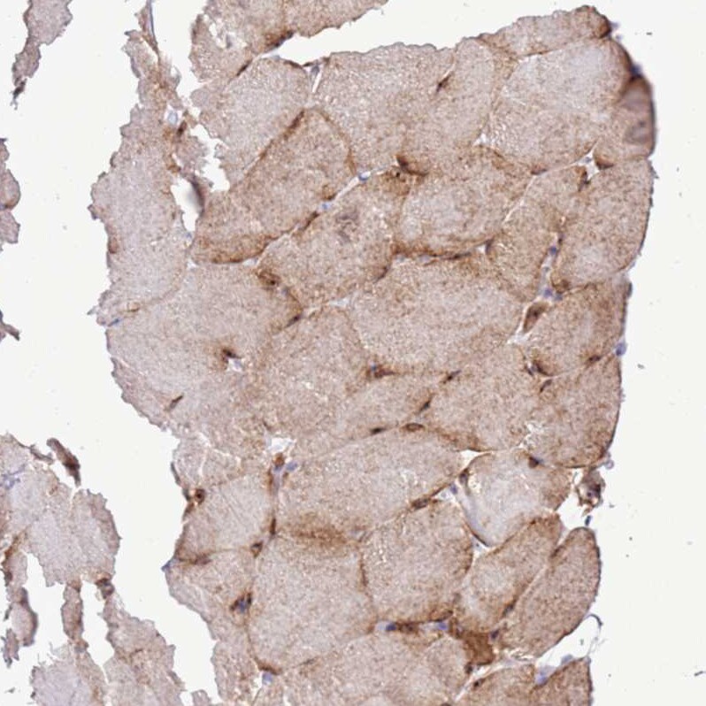 RPL3L Antibody - BSA Free Immunohistochemistry: RPL3L Antibody - BSA Free [NBP2-13257]