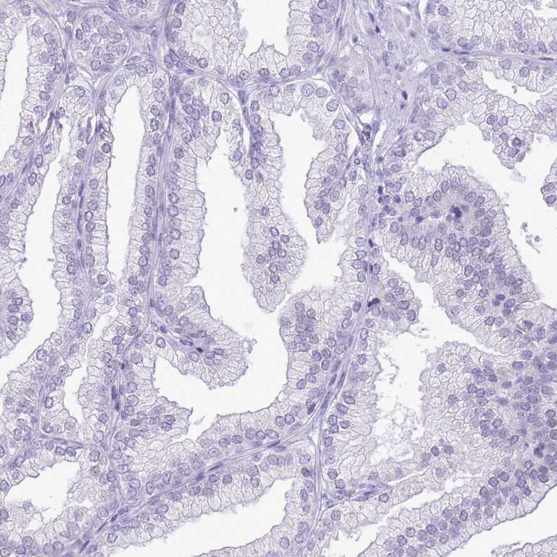 RPL3L Antibody - BSA Free Immunohistochemistry: RPL3L Antibody - BSA Free [NBP2-13257]