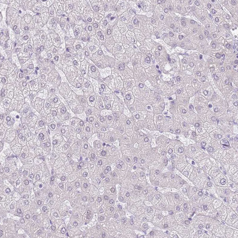 RPL3L Antibody - BSA Free Immunohistochemistry: RPL3L Antibody - BSA Free [NBP2-13257]