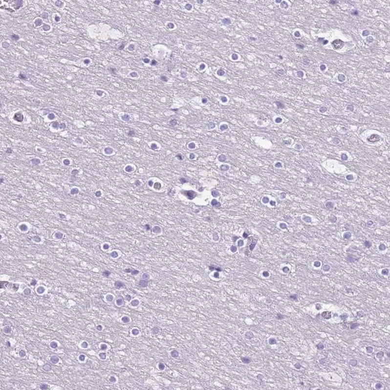 RPL3L Antibody - BSA Free Immunohistochemistry: RPL3L Antibody - BSA Free [NBP2-13257]