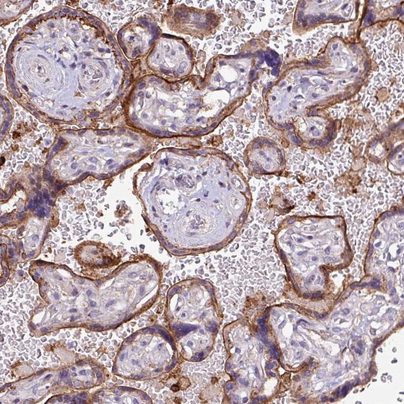 RPP25L Antibody - BSA Free Immunohistochemistry: RPP25L Antibody - BSA Free [NBP2-13259]