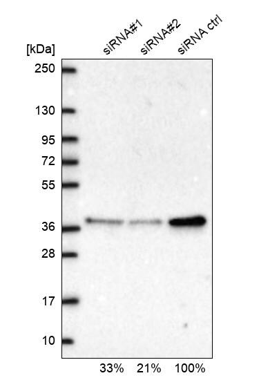 RPP38 Antibody - BSA Free Western Blot: RPP38 Antibody - BSA Free [NBP2-13260]